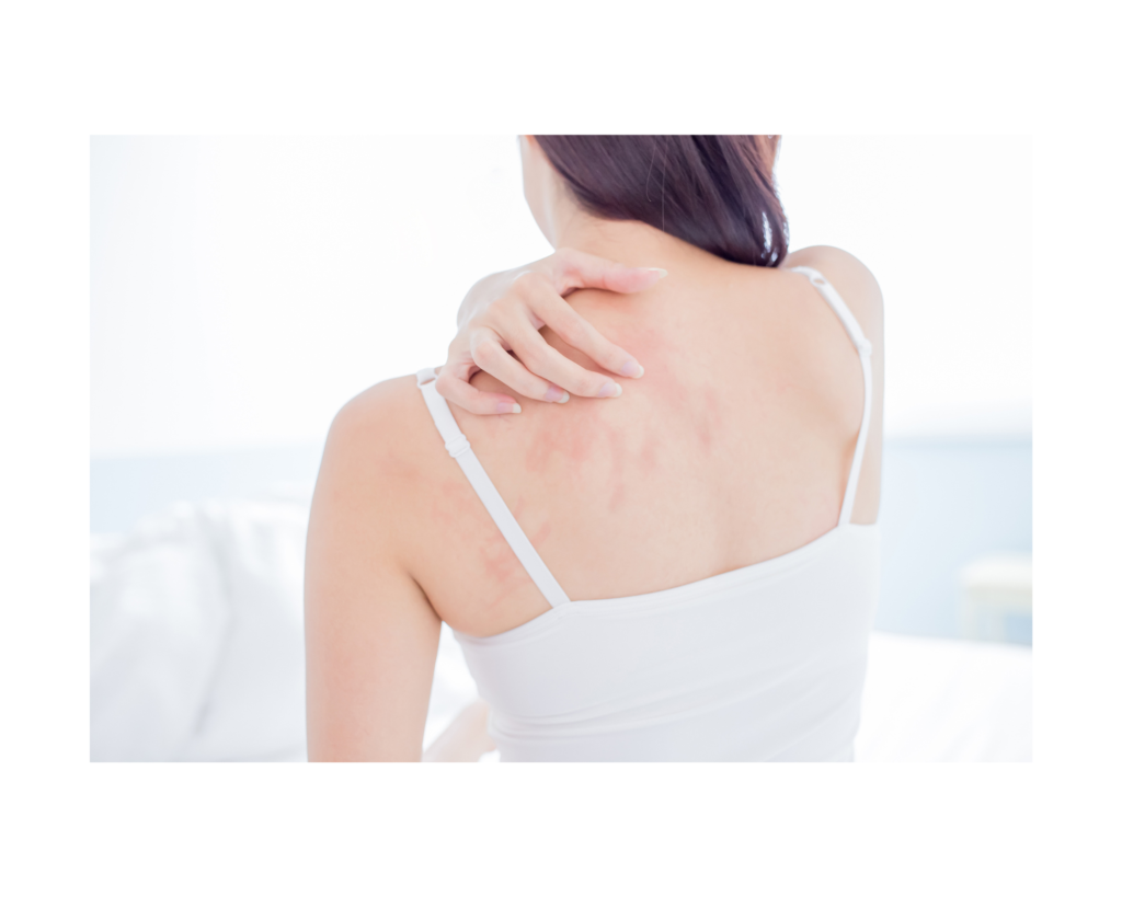  Neck pain can range from irritating to debilitating...dry needling can help with both. 